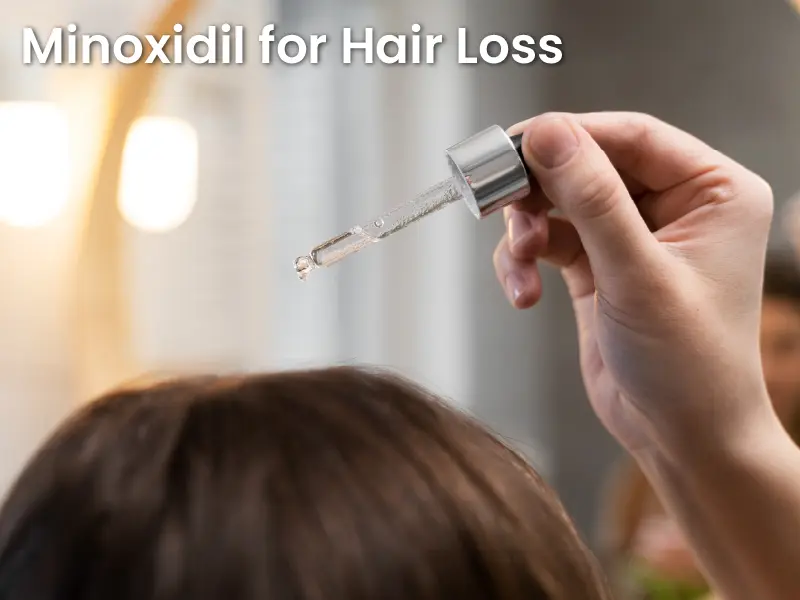 Minoxidil for Hair Loss